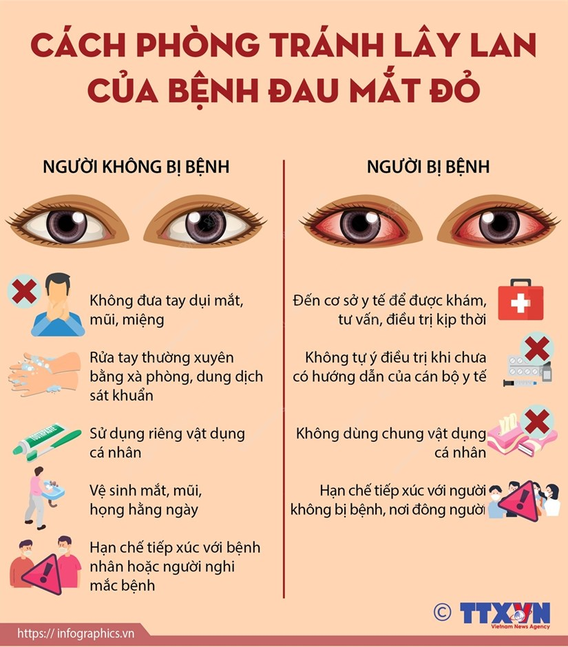 [Infographics] Cách phòng tránh lây lan bệnh đau mắt đỏ