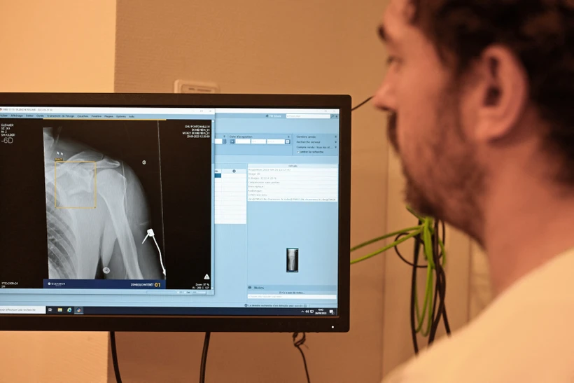 Nga mở rộng ứng dụng trí tuệ nhân tạo trong chẩn đoán hình ảnh X-quang